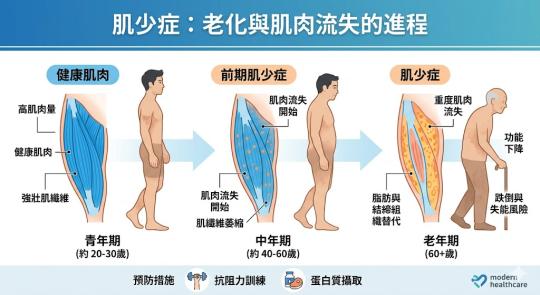 老人肌少症怎麼改善？完整解決方案｜飲食＋營養補充＋運動指南