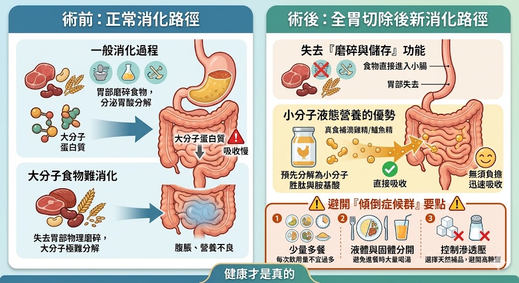 全胃切除後的消化路徑